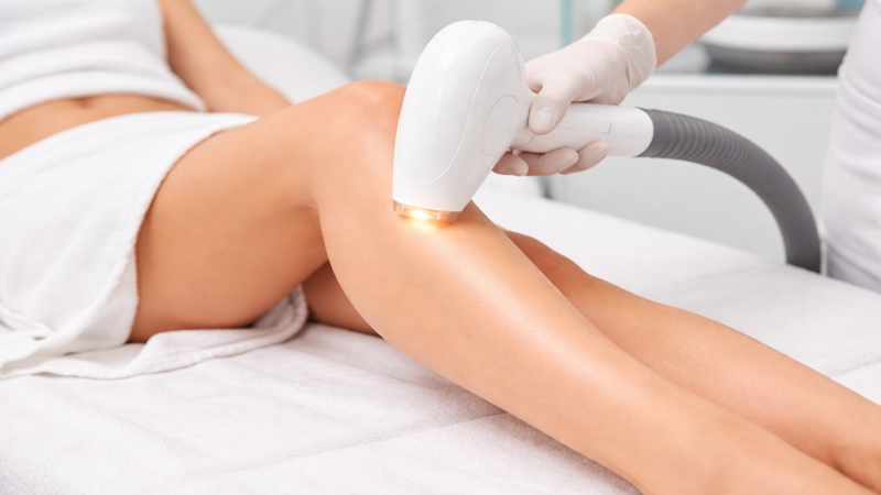 Laser Hair Removal